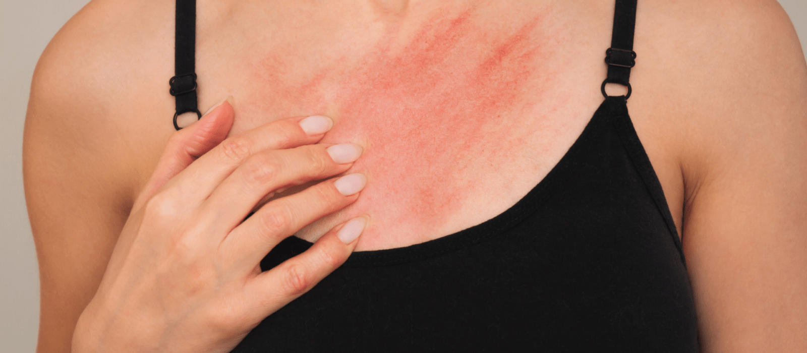 a girl itching her neck