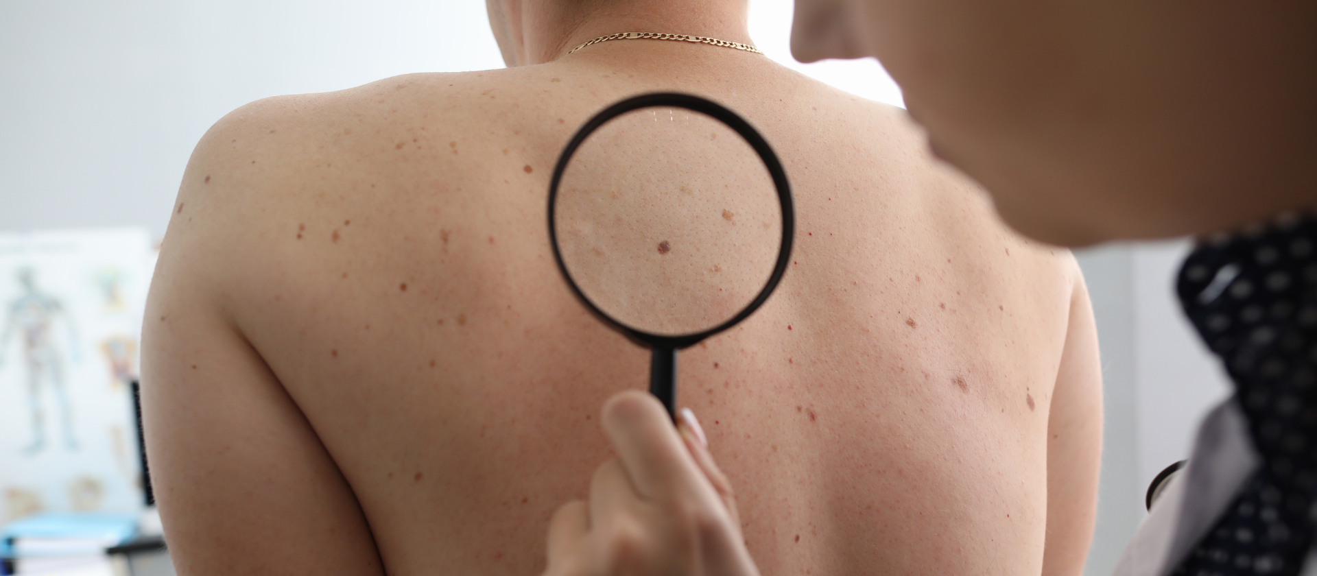 A woman getting a dermatologist opinion on the freckles on her back